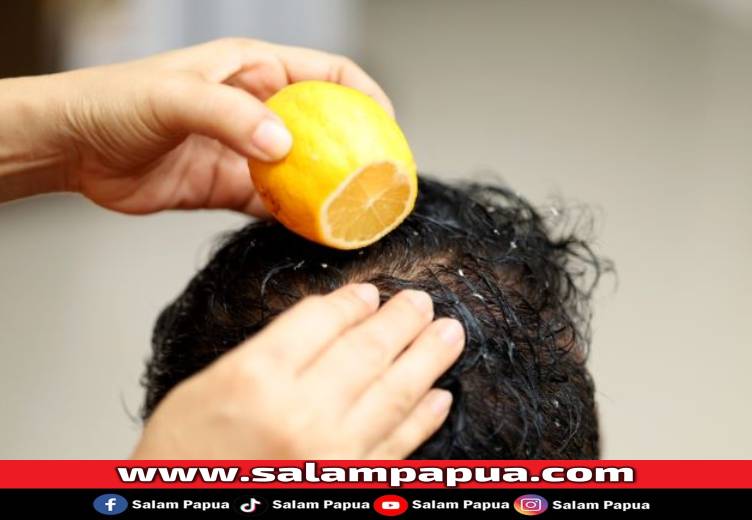 Lemon Untuk Rambut, Bikin Rambut Lebih Subur Dan Bebas Ketombe