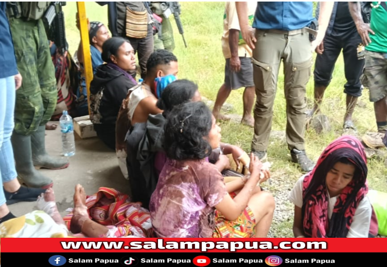 Kabid Humas: Pasca Teror KKB, Kondisi Yahukimo Sudah Kondusif Dan Terkendali