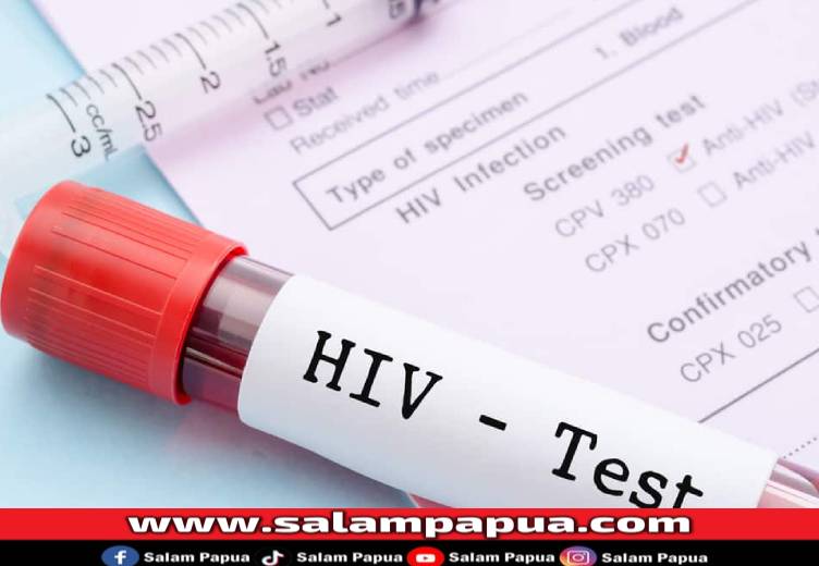 Puskesmas Mapurujaya Temukan 3 Kasus HIV-AIDS Di Bulan Maret 2025