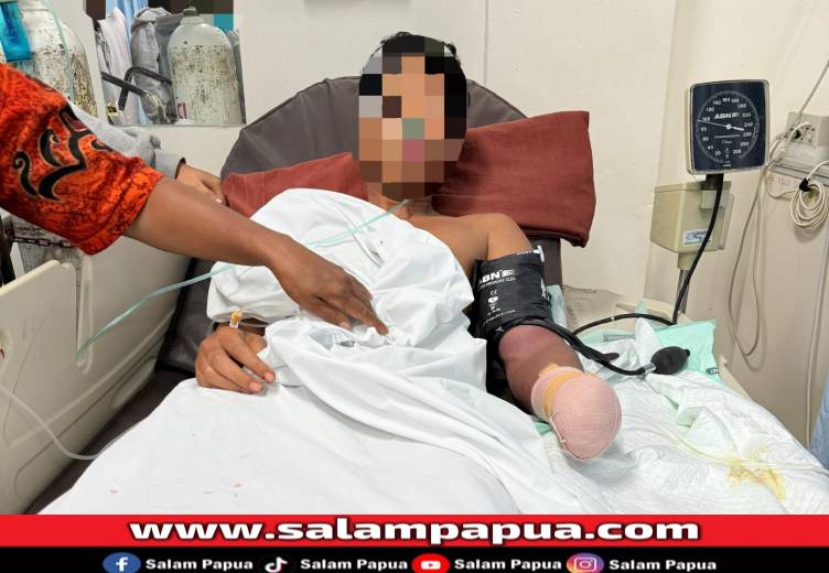Pelajar SMK Di Timika Dibegal Hingga Tangan Terputus Di Jalan Bougenville, Motor Dan HP Raib