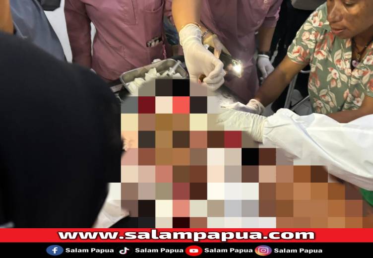 Warga Asal Banten Jadi Korban Pembacokan Oleh KKB Di Yahukimo