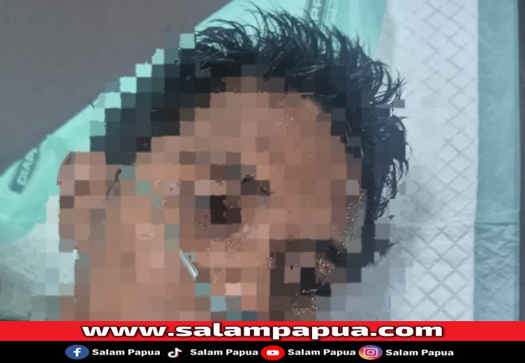 Usai Hadiri Acara Keluarga, Seorang Pria Ditikam Enam OTK Di SP 1 Timika