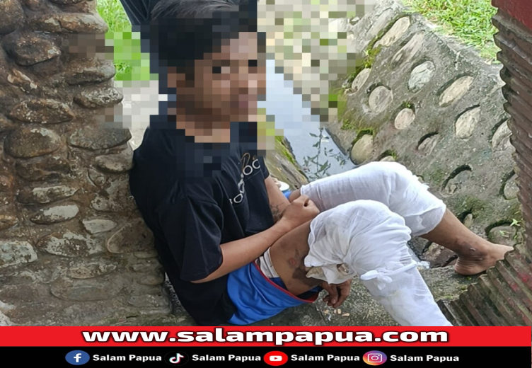 Nganggur Jadi Alasan Cika Nekat Bakar Ipai Hingga Kos-kosan Di SP 3 Terbakar