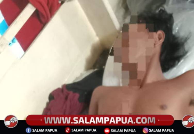 Pesta Miras Di Atas Kapal, Tiga Nelayan Jadi Korban Penikaman, Pelaku Diamankan Polisi