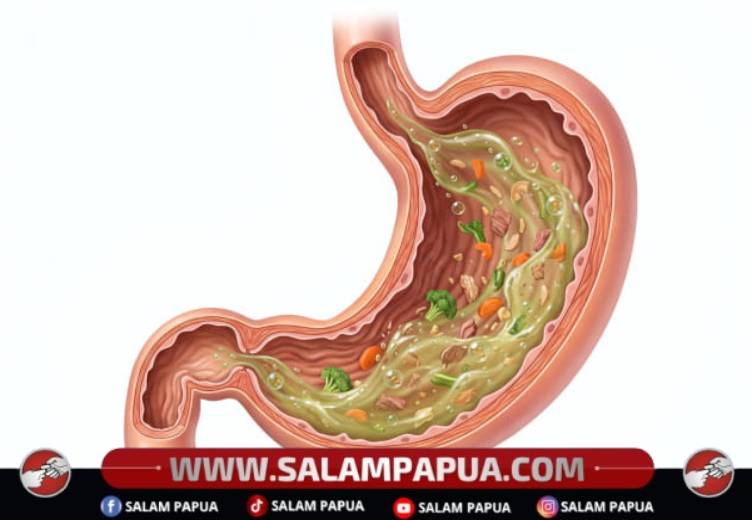 Berikut Fungsi Asam Lambung Bagi Kesehatan Pencernaan