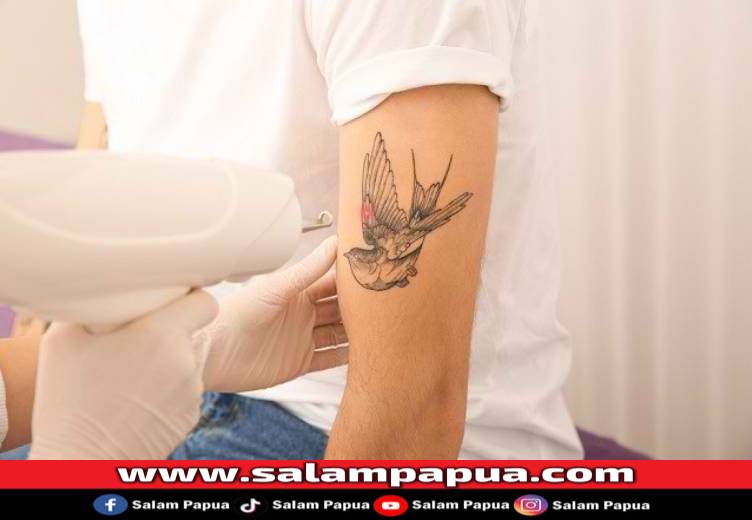 3 Cara Menghilangkan Tato Permanen Secara Medis