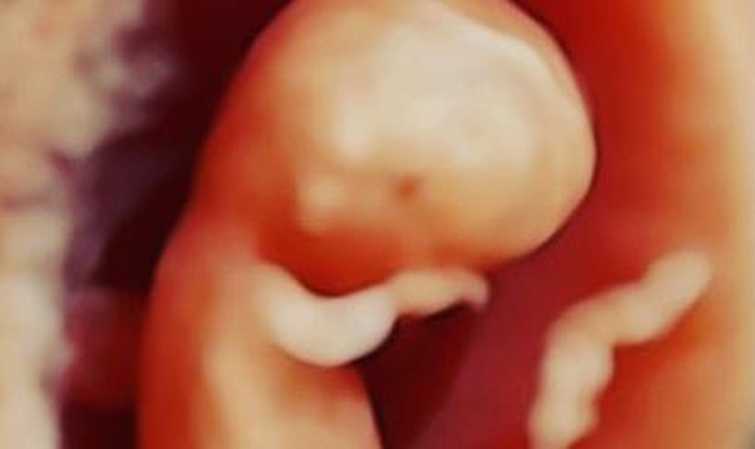 ISU ABORSI MARAK DI TIMIKA, ITU MELANGGAR HUKUM DAN ORANG TUA PERLU PERHATIKAN ANAK SECARA INTENS