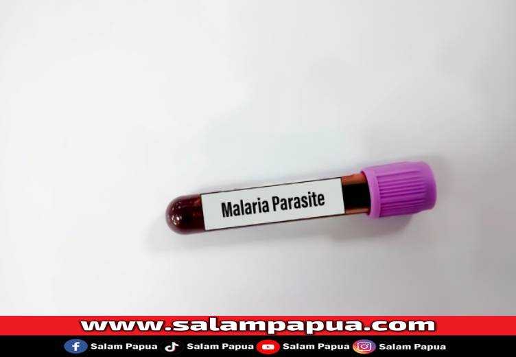Plasmodium, Parasit Penyebab Malaria Yang Perlu Diwaspadai