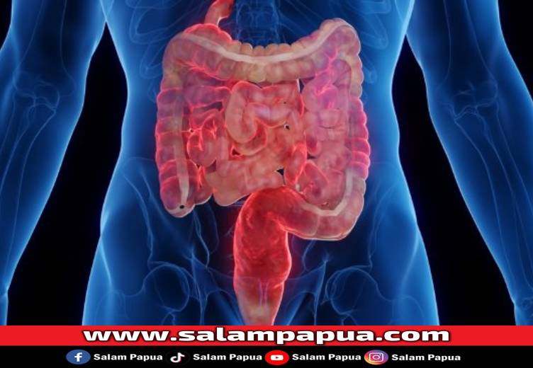 Usus Kotor, Kenali Tanda Dan Cara Mengatasinya
