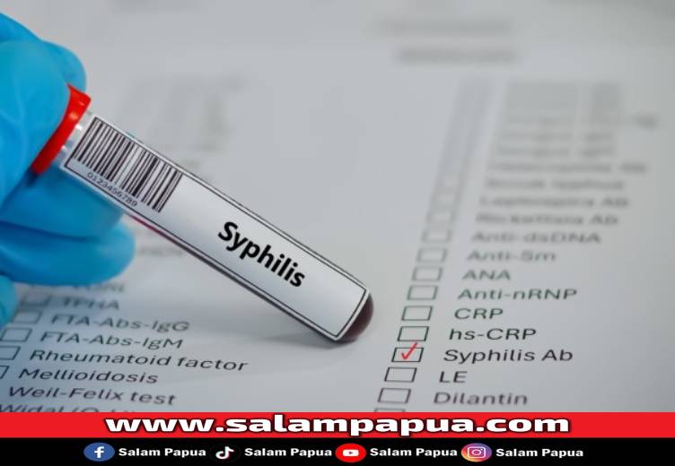 Treponema Pallidum, Bakteri Penyebab Sifilis Yang Perlu Diwaspadai
